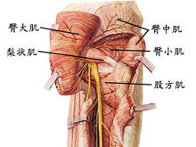 梨状肌综合征的图片