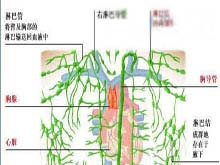 淋巴管肉瘤的图片