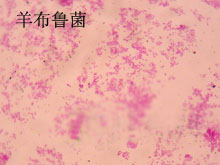 布氏杆菌病的图片