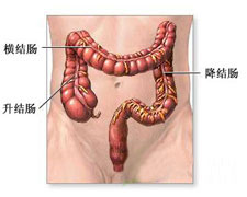 慢性溃疡性结肠炎的图片