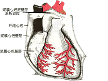 慢性缩窄性心包炎的图片