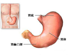 慢性胃炎的图片