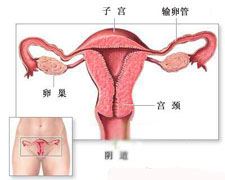 慢性子宫内膜炎的图片