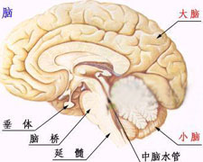 脑垂体腺瘤的图片