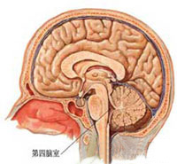 脑结核瘤的图片