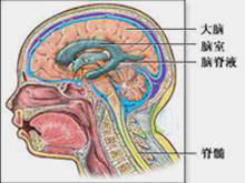 脑疝的图片