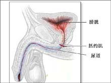 尿道与阴茎结核的图片