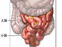 肠结核的图片