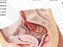 盆底痉挛综合症的图片