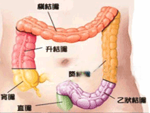 肠气肿综合征的图片