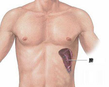 脾-肝综合征的图片