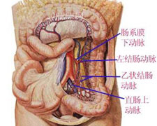 肠系膜上动脉栓塞的图片