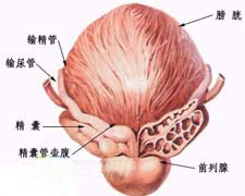 前列腺增生的图片
