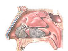 上颌窦后鼻孔息肉的图片