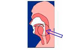 舌甲状腺的图片