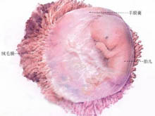 胎儿宫内窘迫的图片