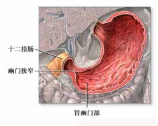 特发性胃肠道嗜酸性细胞浸润综合征的图片