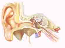 突发性耳聋的图片