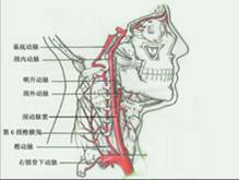外伤性颈内动脉海绵窦瘘的图片