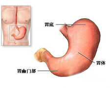 胃癌的图片