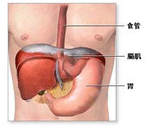 胃肠道伴癌综合征的图片
