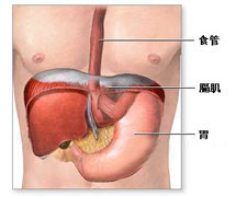 胃粘膜脱垂症的图片