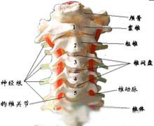 无脊髓损伤的颈椎骨折脱位的图片