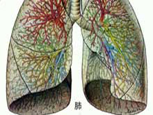 吸入性肺炎的图片