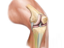 损伤 膝关节/疾病名称：膝关节侧副韧带损伤