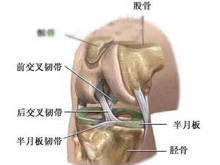 膝关节创伤性滑膜炎的图片