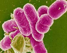 细菌性痢疾的图片