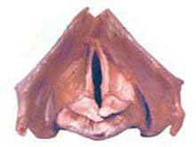 先天性小喉的图片