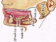 腺淋巴瘤的图片