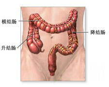 大肠梗阻的图片