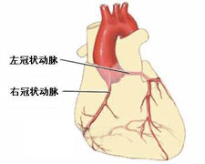 胸降主动脉动脉瘤的图片