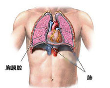 胸腔积液的图片