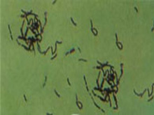 丹毒丝菌病的图片