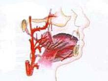 咽血管畸形的图片