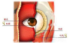 眼内转移性肿瘤的图片