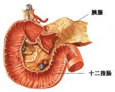 胰腺脓肿的图片