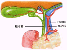 胆道运动功能障碍综合征的图片