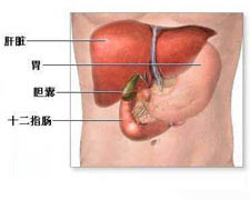 胆管结石与胆管炎的图片