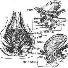 直肠损伤的图片