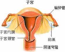 子宫内膜癌的图片