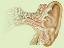 耳内脑膜脑疝的图片