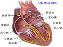 房室传导阻滞的图片