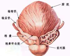 非细菌性前列腺炎的图片
