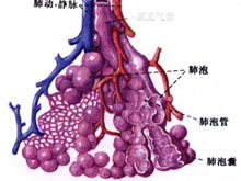 肺泡蛋白质沉积症的图片