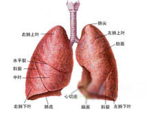 肺栓塞和肺梗死的图片