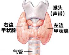 Graves病的图片